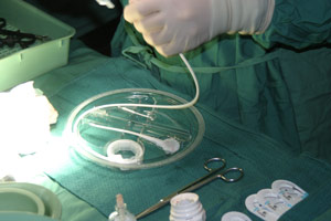 The Operation